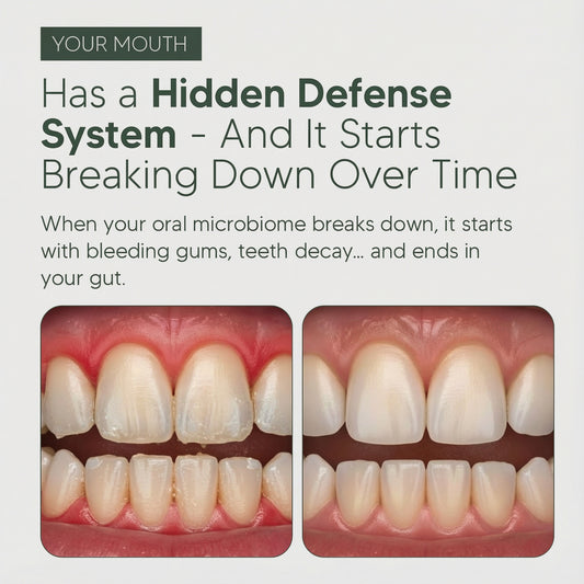 Oral Defence – Maximum Potency Oral Microbiome Restoration by Skeptra™